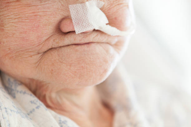 Guia Completo sobre Sonda Nasoenteral (SNE)