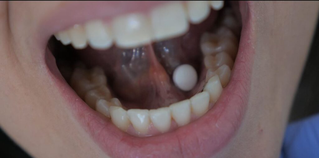 Via Sublingual